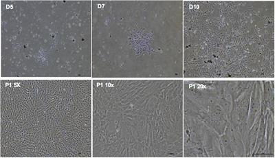 Dental pulp stem cells retain mesenchymal phenotype despite differentiation toward retinal neuronal fate in vitro